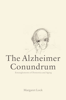 The Alzheimer Conundrum